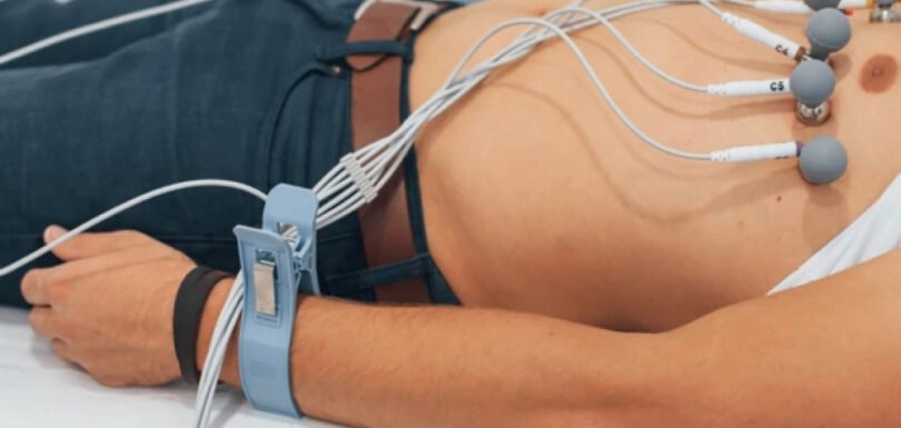Elektrokardiogrāfija (EKG)