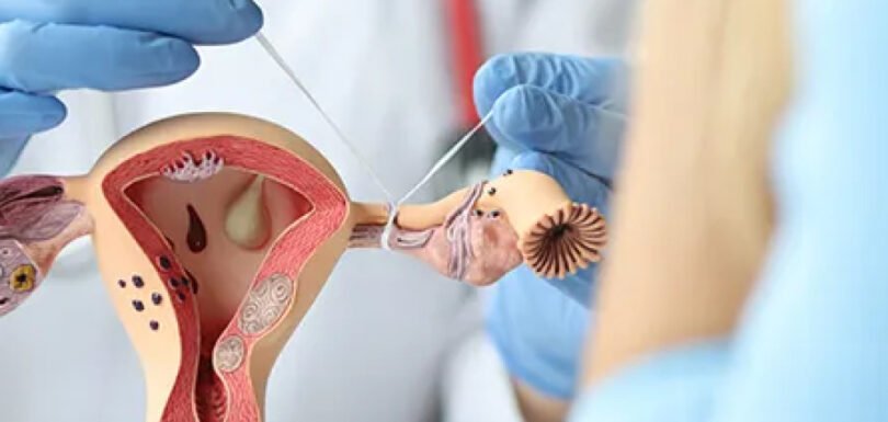 Ginekoloģiskās manipulācijas
